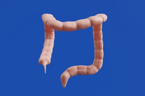 Photo Digestive Discomfort